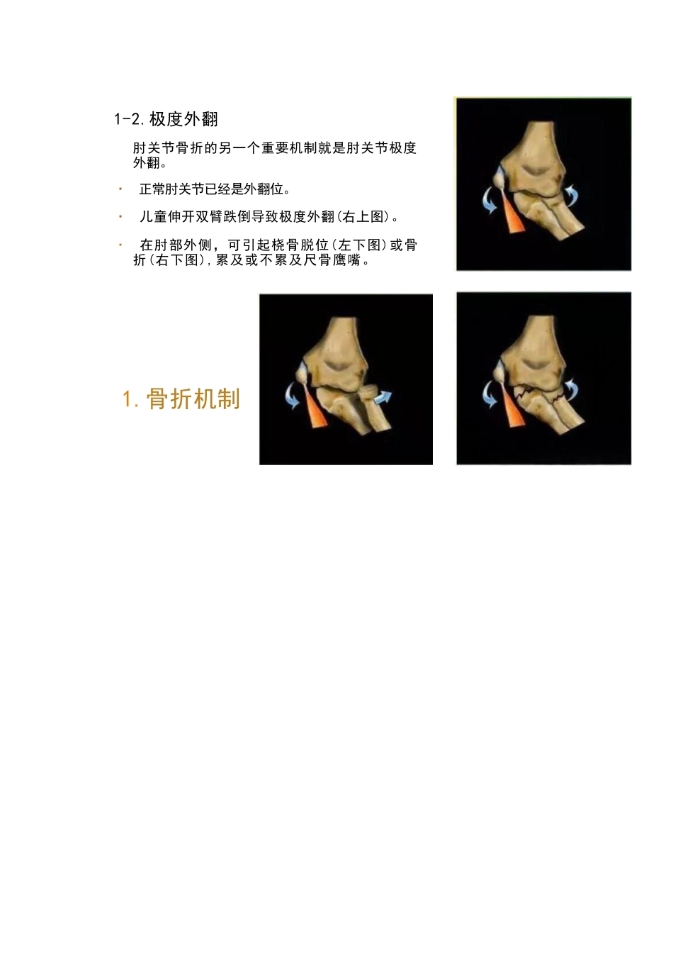 儿童肘关节骨折的分类与诊断要点_第5页