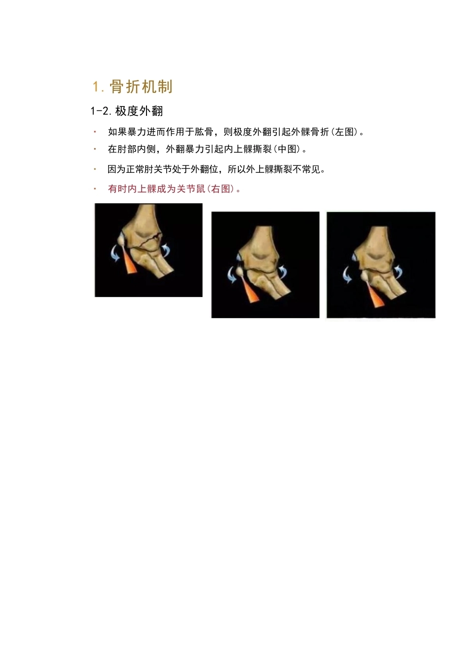 儿童肘关节骨折的分类与诊断要点_第6页