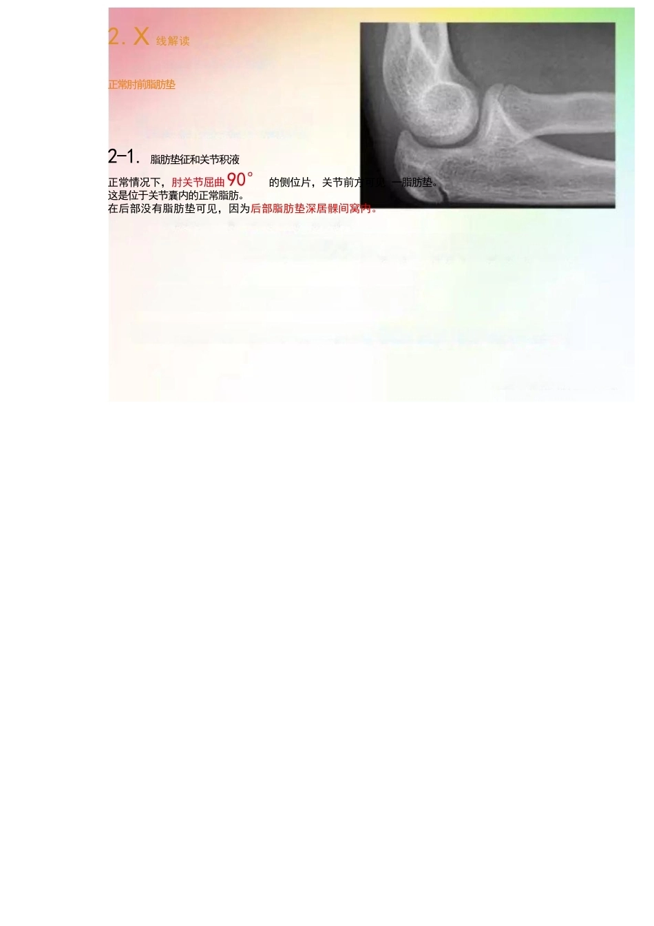 儿童肘关节骨折的分类与诊断要点_第9页