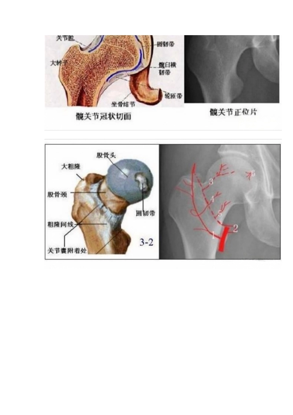 股骨头缺血性坏死的分期及诊断要点_第1页