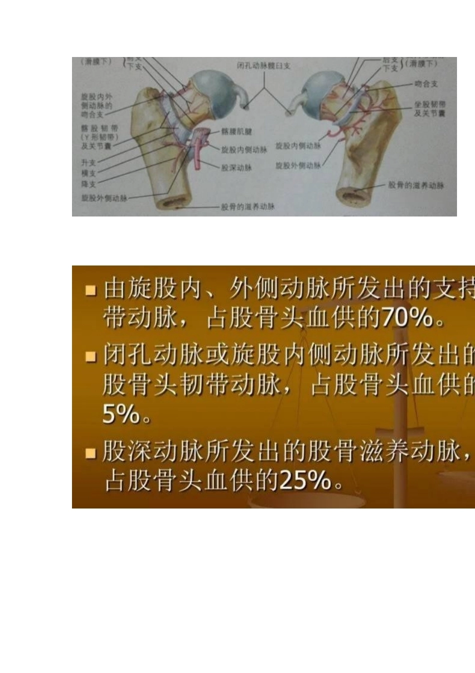 股骨头缺血性坏死的分期及诊断要点_第2页