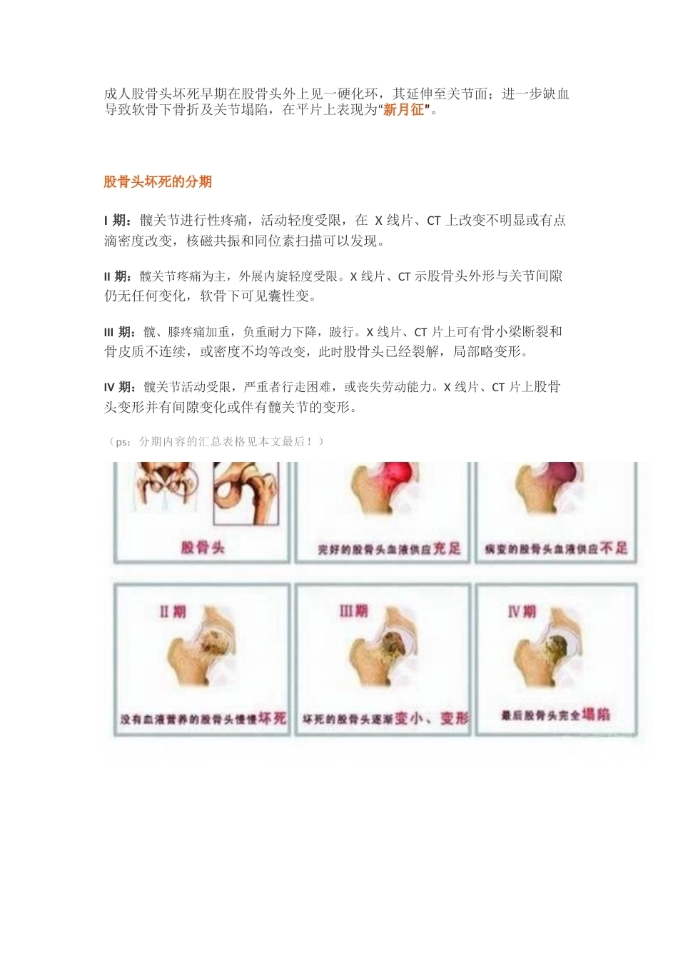 股骨头缺血性坏死的分期及诊断要点_第4页