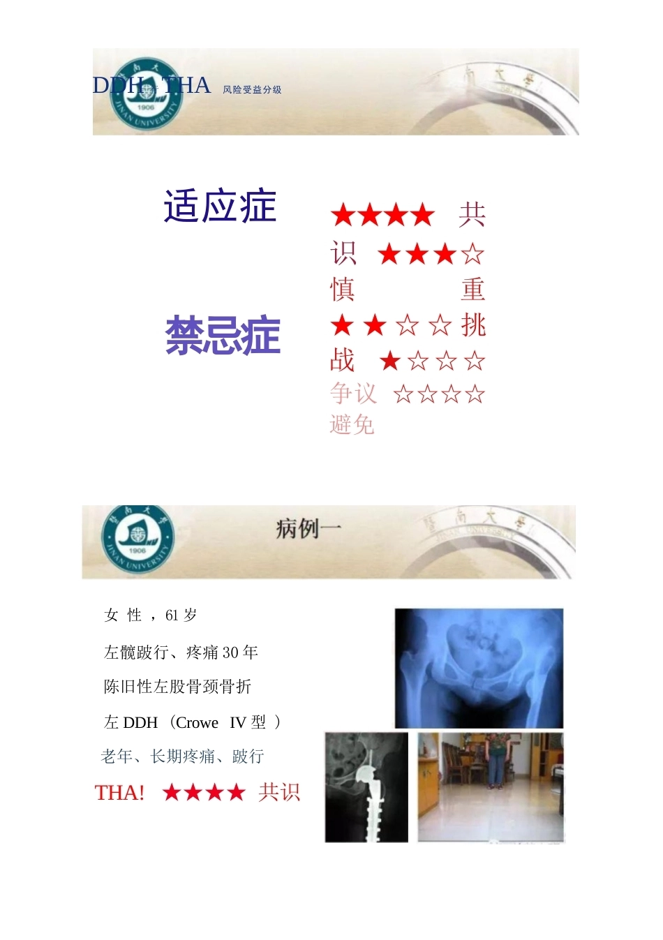 DDH全髋 关节置换术的适应症及禁忌症_第3页