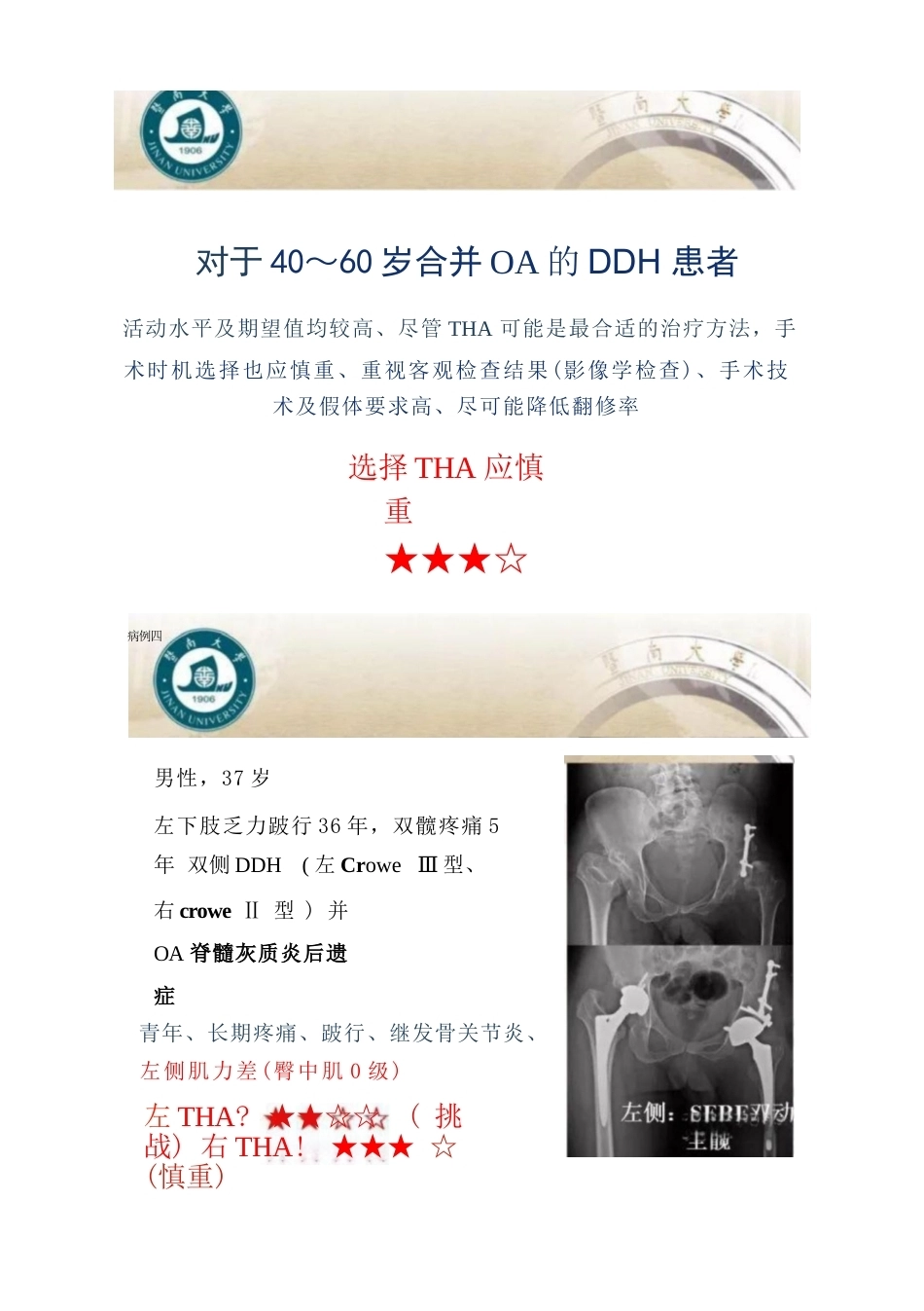 DDH全髋 关节置换术的适应症及禁忌症_第6页