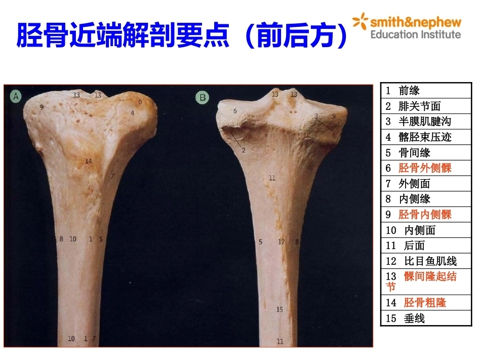 膝关节周围解剖与手术 入路_第11页