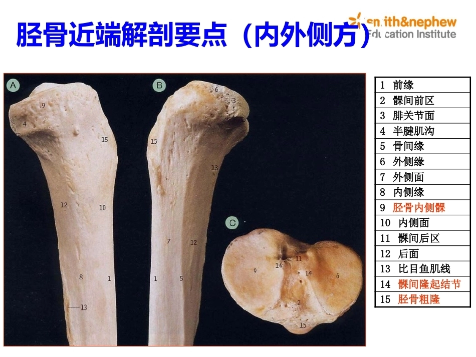 膝关节周围解剖与手术 入路_第12页