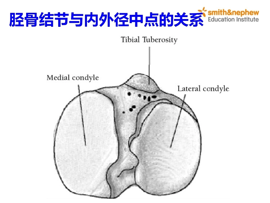 膝关节周围解剖与手术 入路_第13页