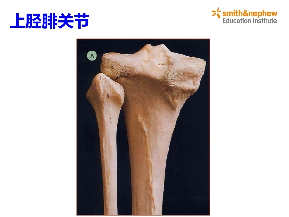 膝关节周围解剖与手术 入路_第14页