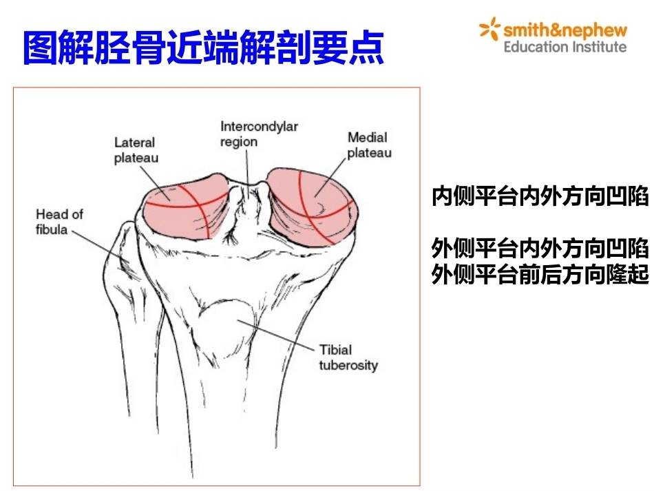 膝关节周围解剖与手术 入路_第15页