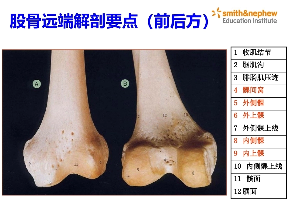 膝关节周围解剖与手术 入路_第4页