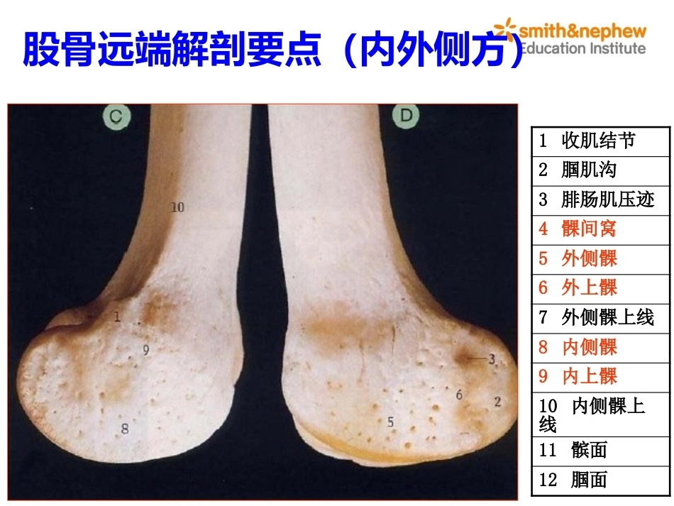 膝关节周围解剖与手术 入路_第5页