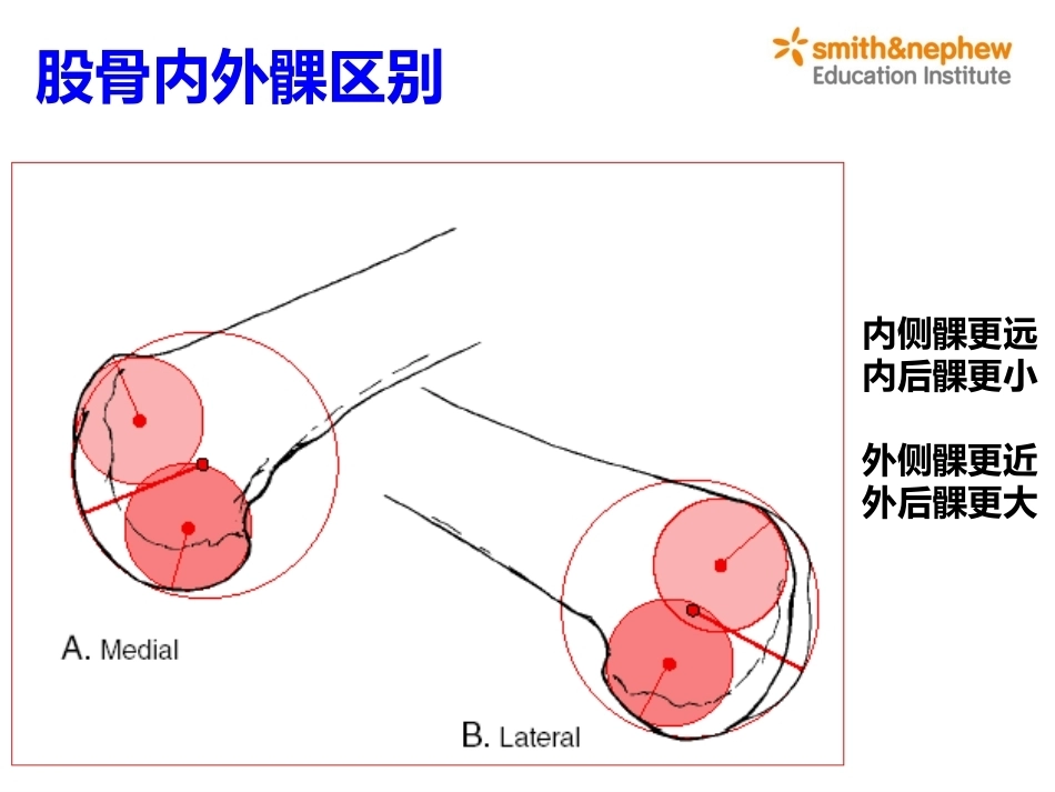 膝关节周围解剖与手术 入路_第9页