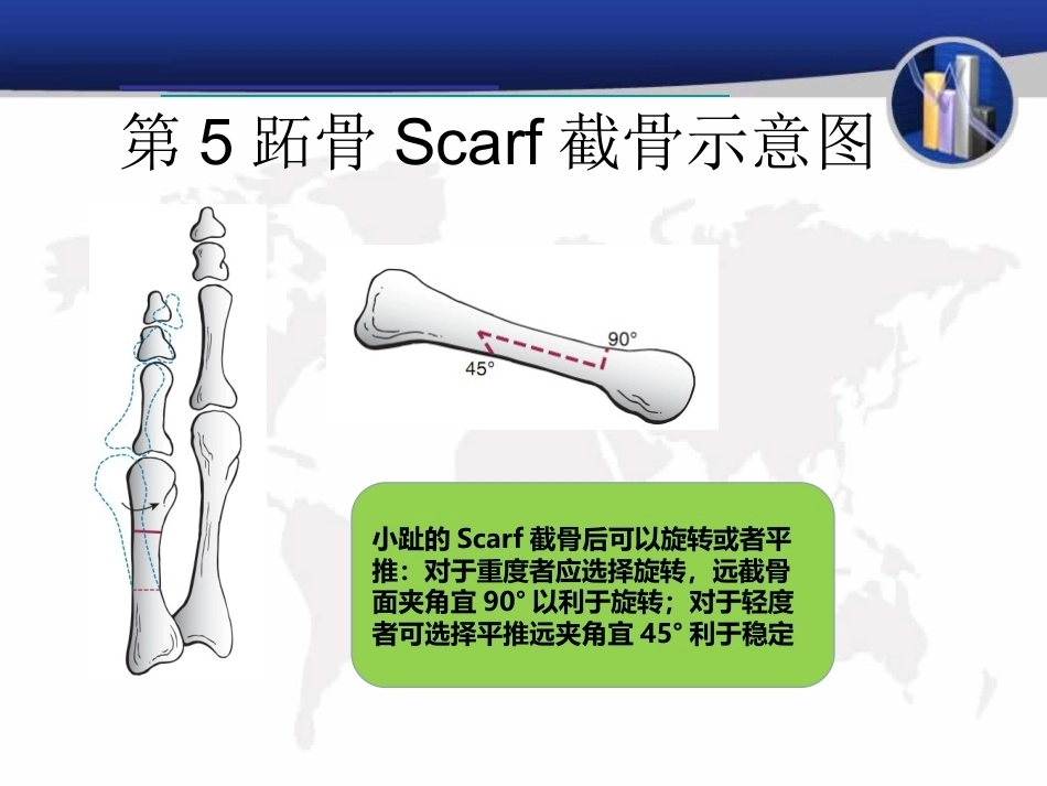 小趾囊 炎_第11页