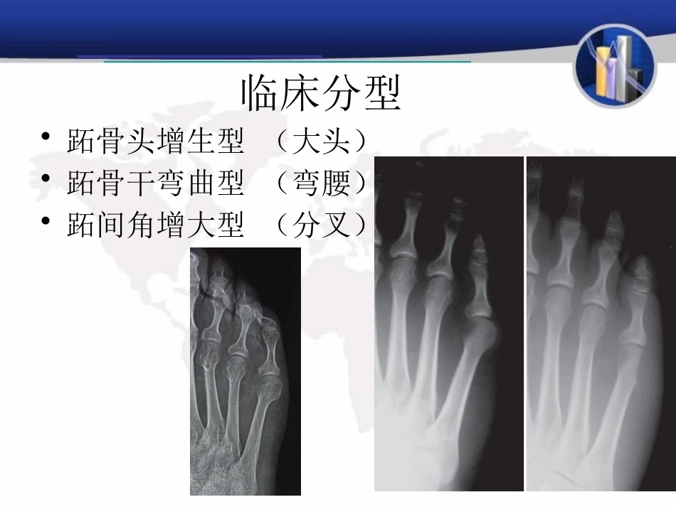 小趾囊 炎_第8页