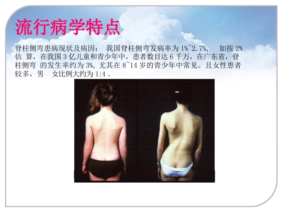 脊柱侧弯的诊 断及治疗_第3页