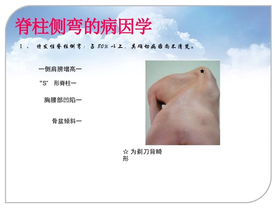 脊柱侧弯的诊 断及治疗_第4页