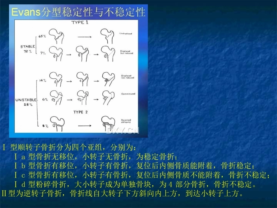 股骨转子间骨折的分型、治疗_第10页