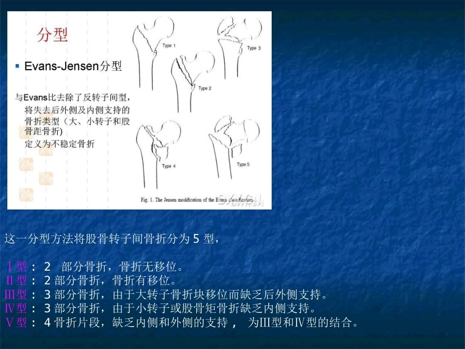 股骨转子间骨折的分型、治疗_第12页