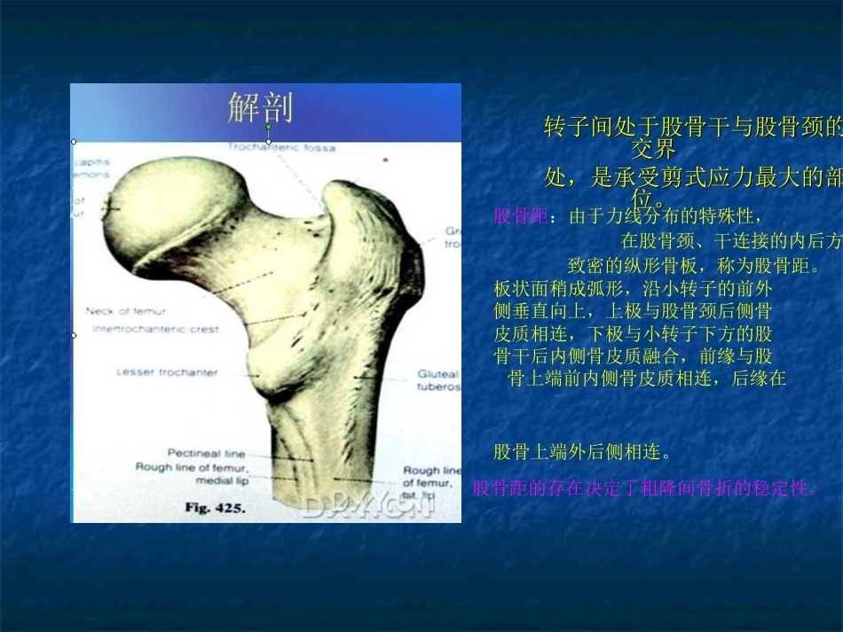 股骨转子间骨折的分型、治疗_第4页