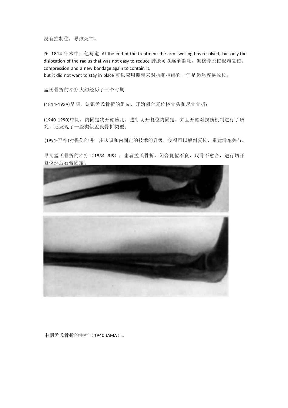 孟氏骨折的分类_第3页