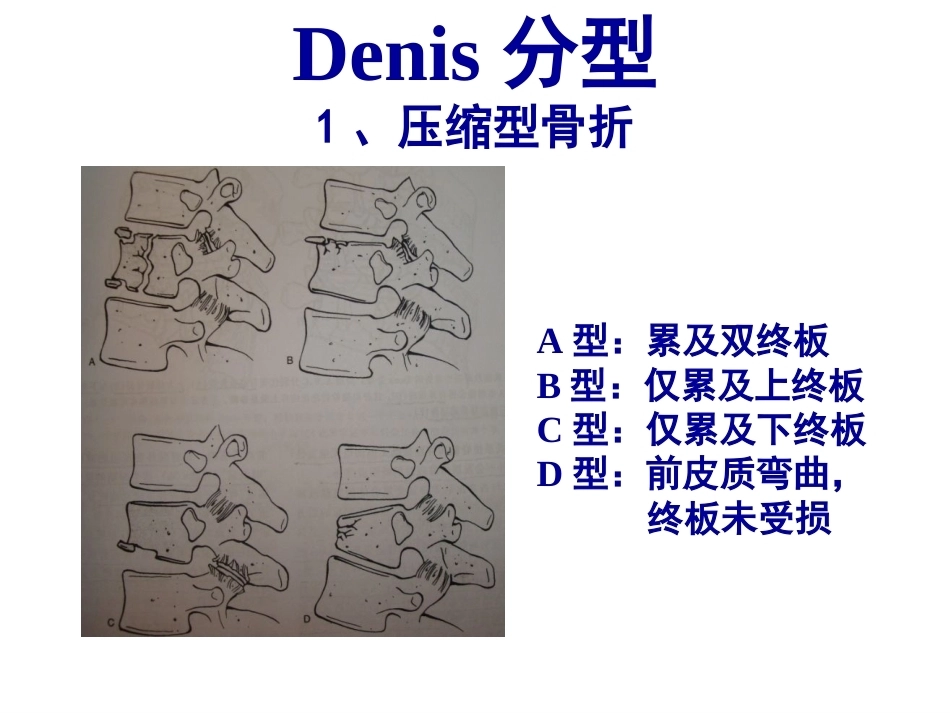 胸腰段脊柱骨折内固 定范围的选择_第10页