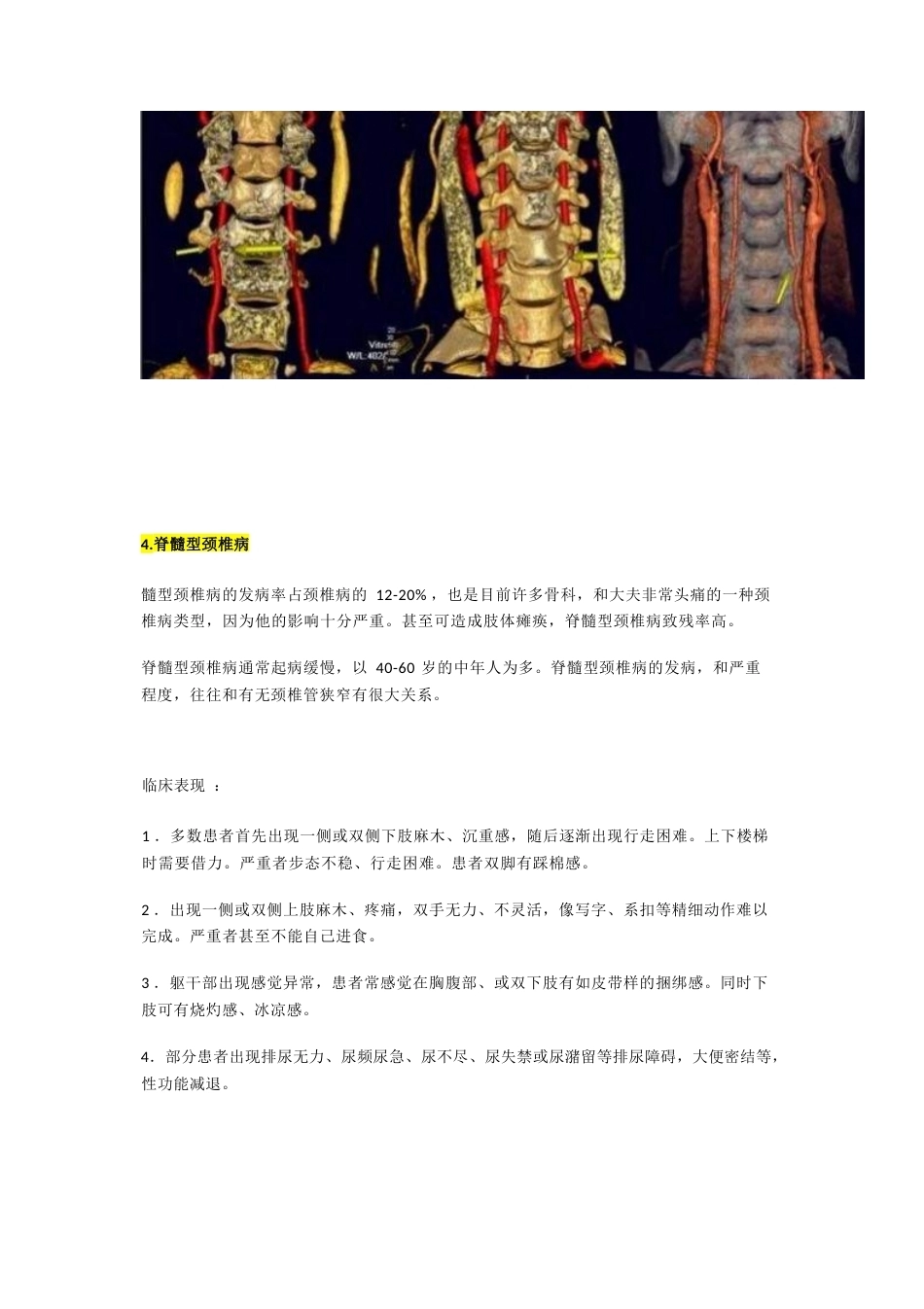 颈椎病分型及临床表现_第7页