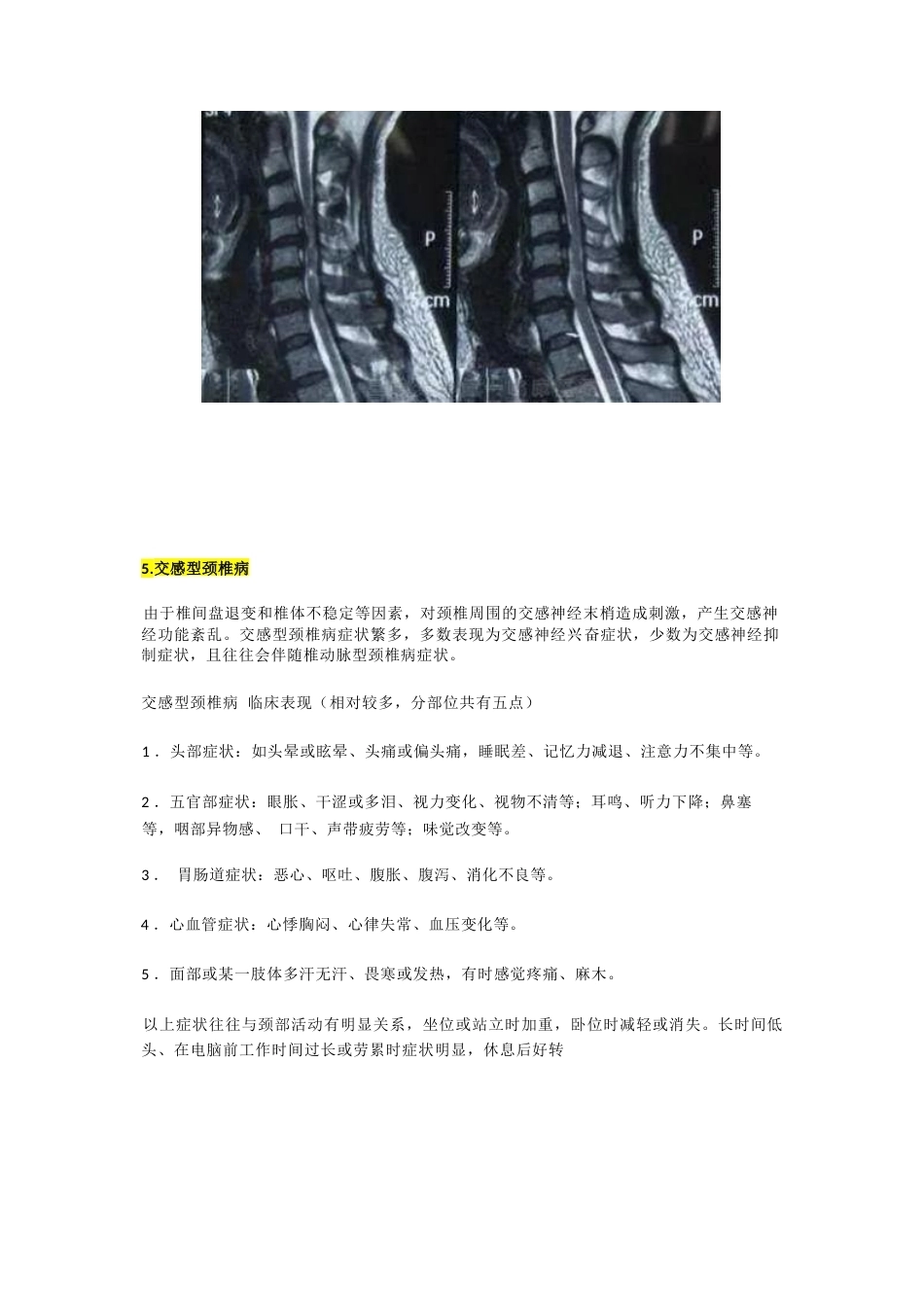 颈椎病分型及临床表现_第8页