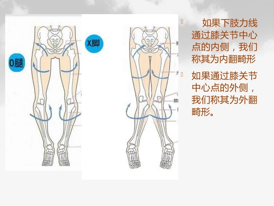 全膝膝关节 置换基本理论_第10页