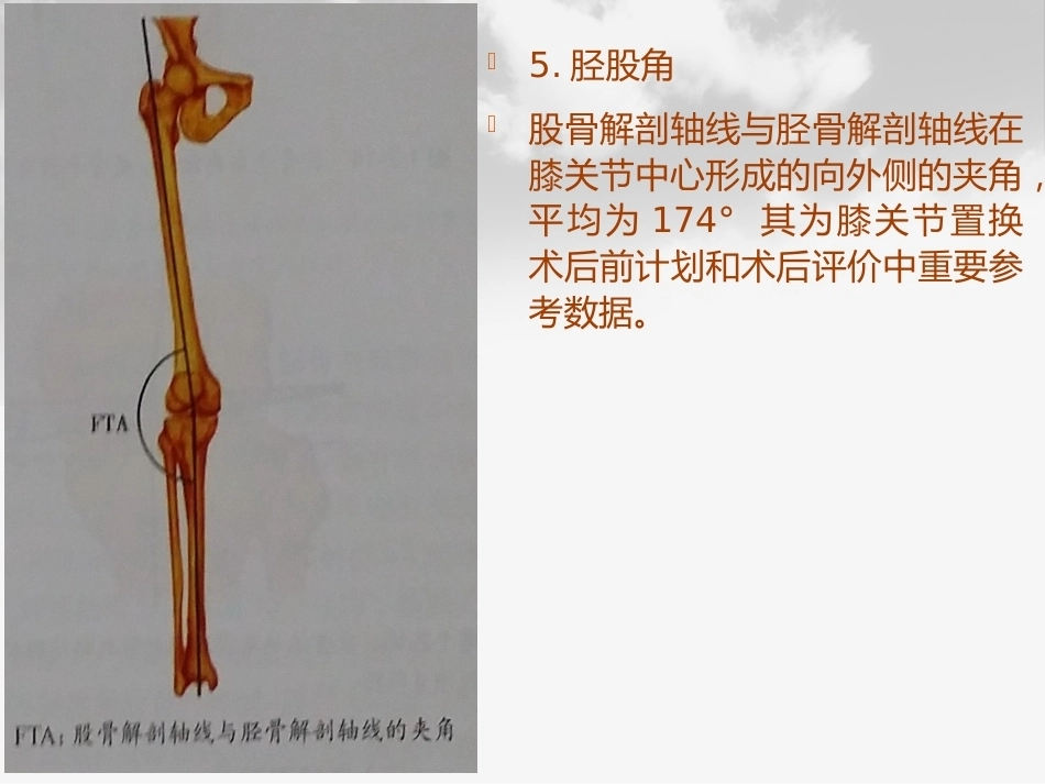 全膝膝关节 置换基本理论_第15页
