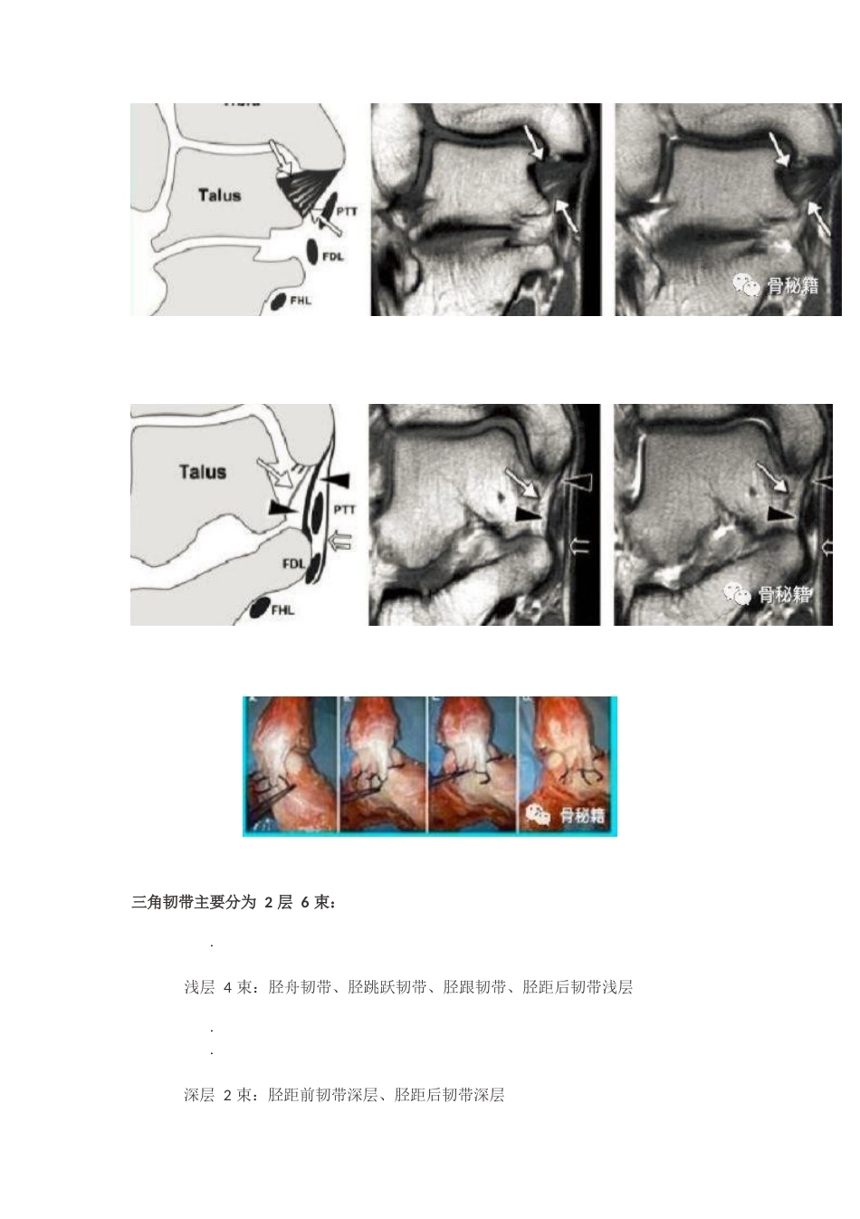 内踝三角韧带 应力测试_第2页