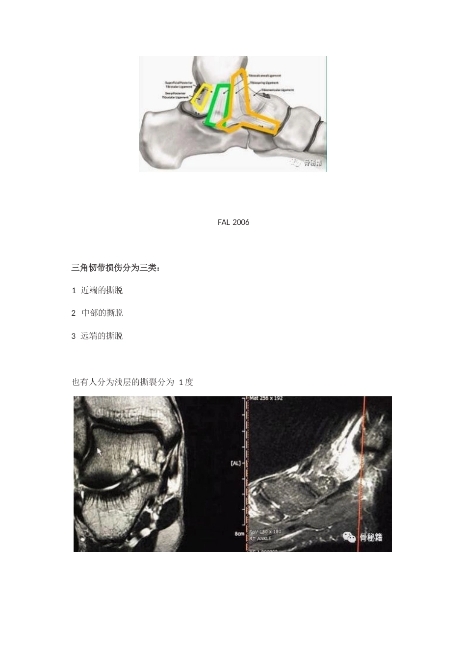 内踝三角韧带 应力测试_第4页
