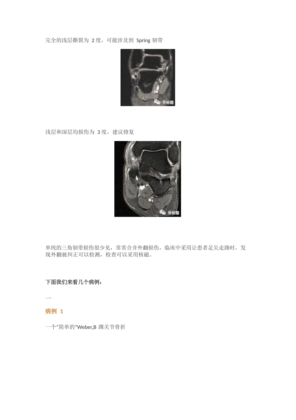 内踝三角韧带 应力测试_第5页