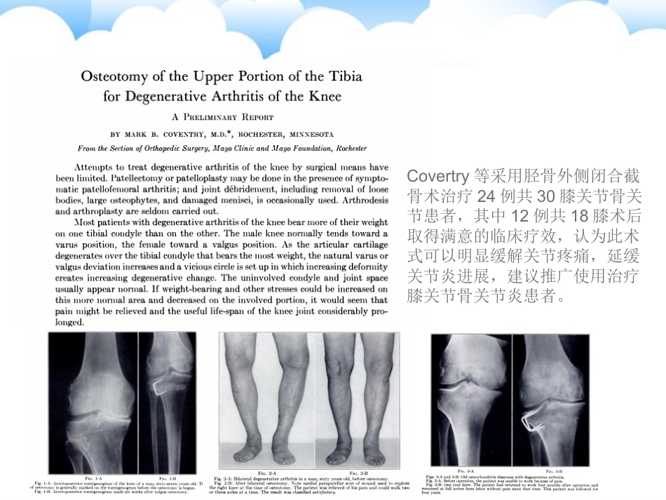 保膝治疗之一胫骨高位截骨术_第5页