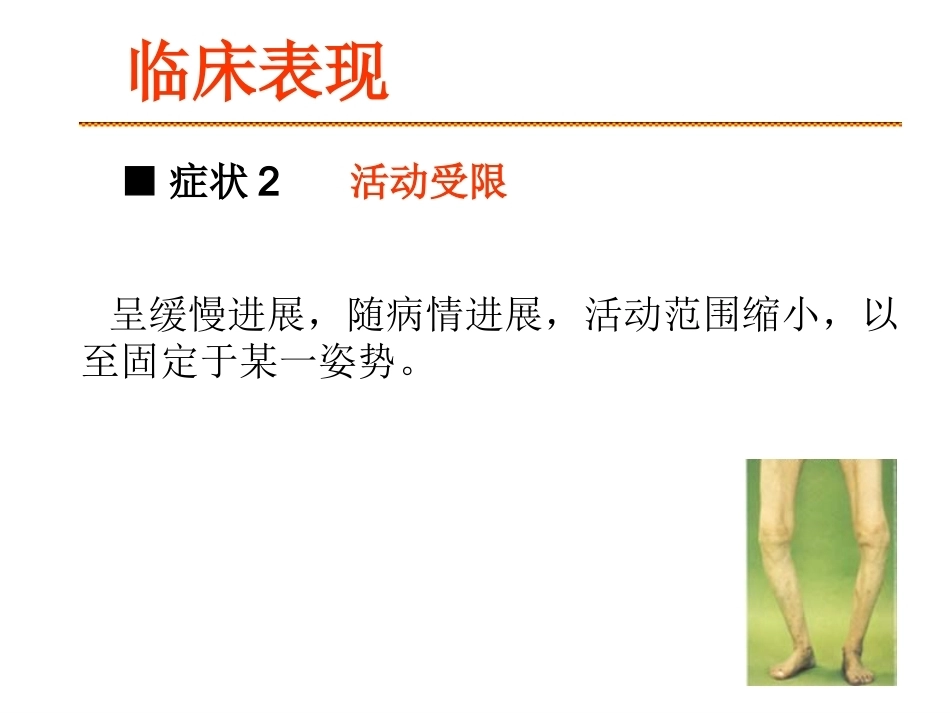 膝关节骨关 节炎_第11页