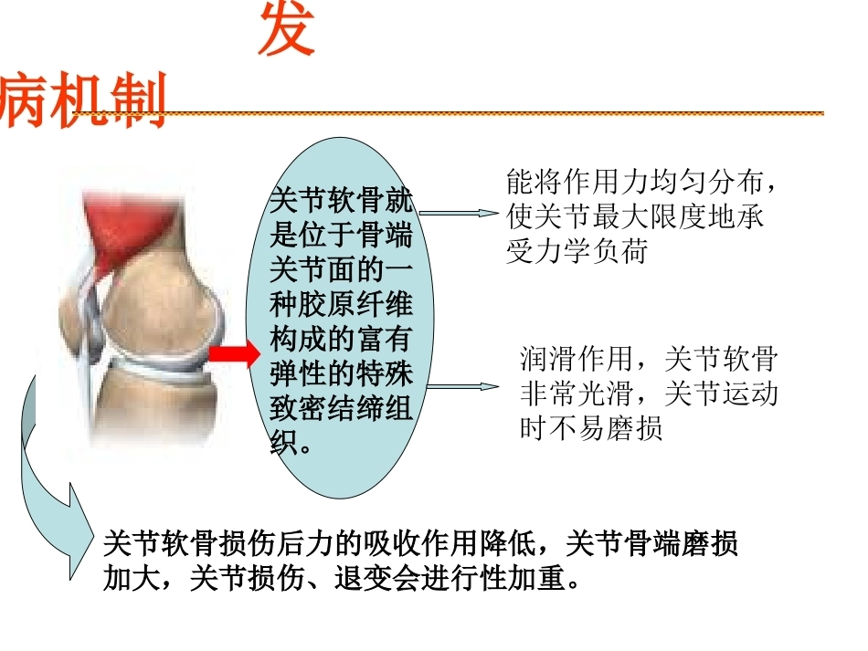 膝关节骨关 节炎_第8页
