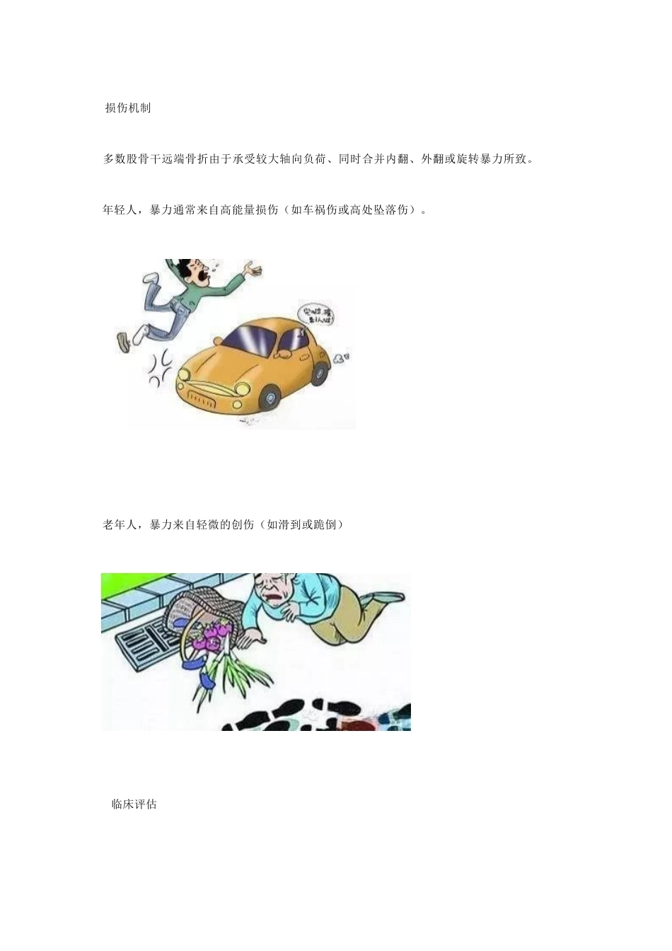 股骨远端骨折，固定方式决定手术成败_第5页