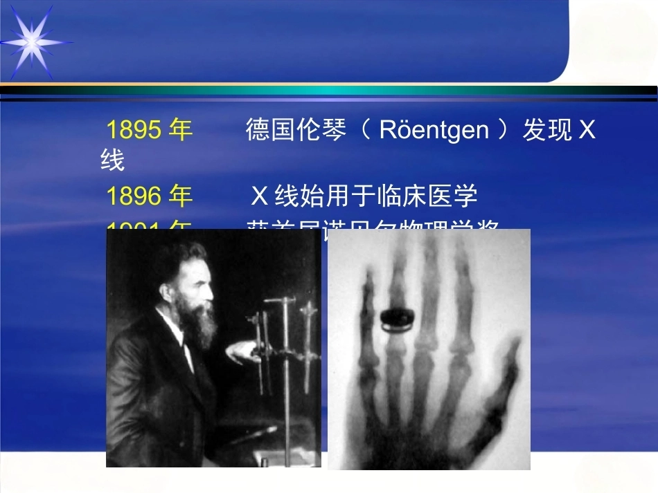 胸腰椎骨 折_第10页