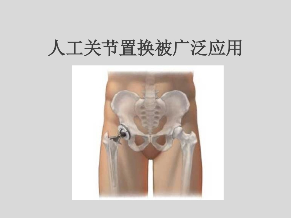 冲击波疗法治疗股骨头坏死(1)_第11页