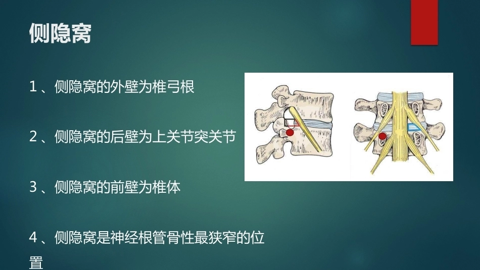 椎间孔的解剖 (1)_第10页