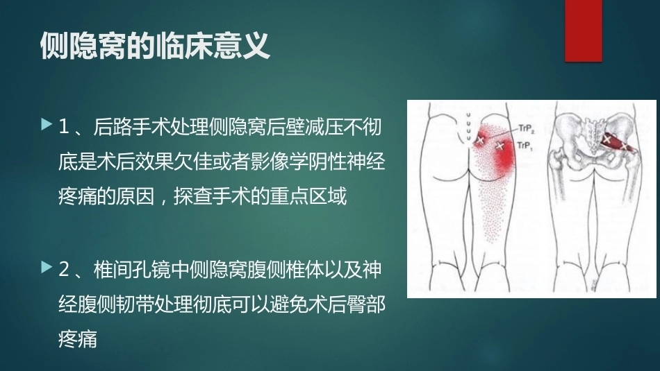 椎间孔的解剖 (1)_第11页
