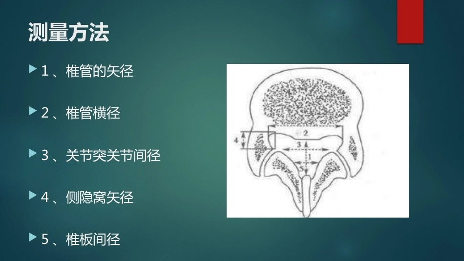 椎间孔的解剖 (1)_第12页