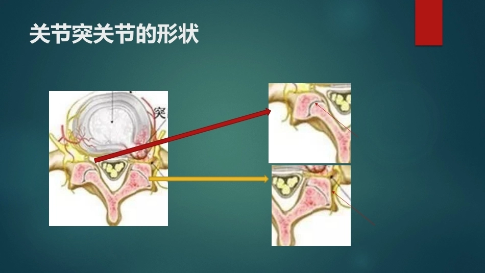 椎间孔的解剖 (1)_第13页