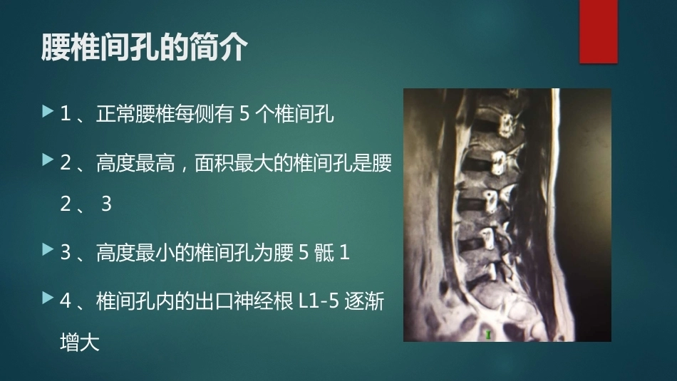 椎间孔的解剖 (1)_第2页
