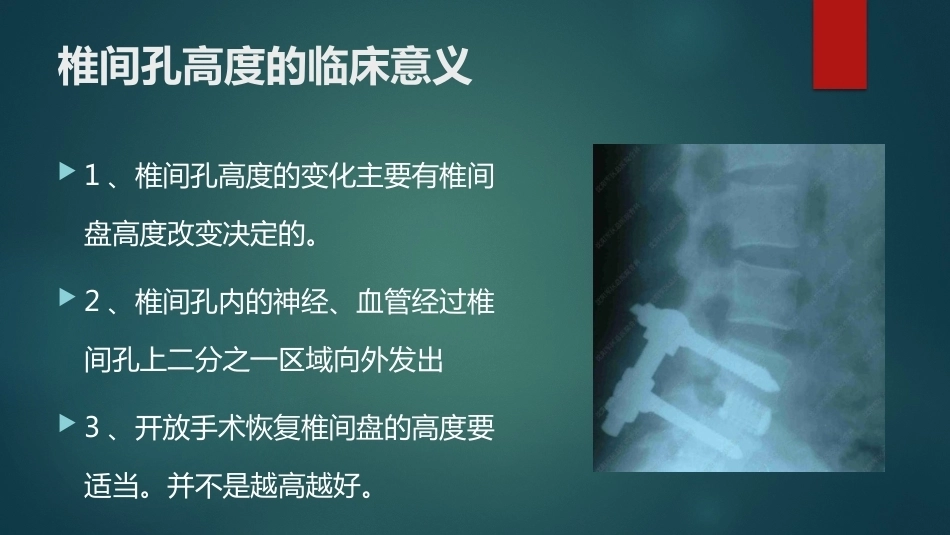 椎间孔的解剖 (1)_第6页