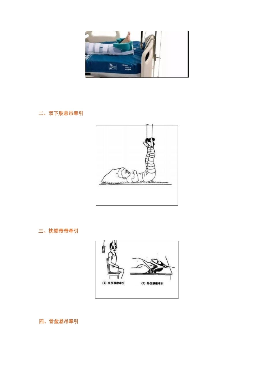 骨科牵引 术(1)_第2页