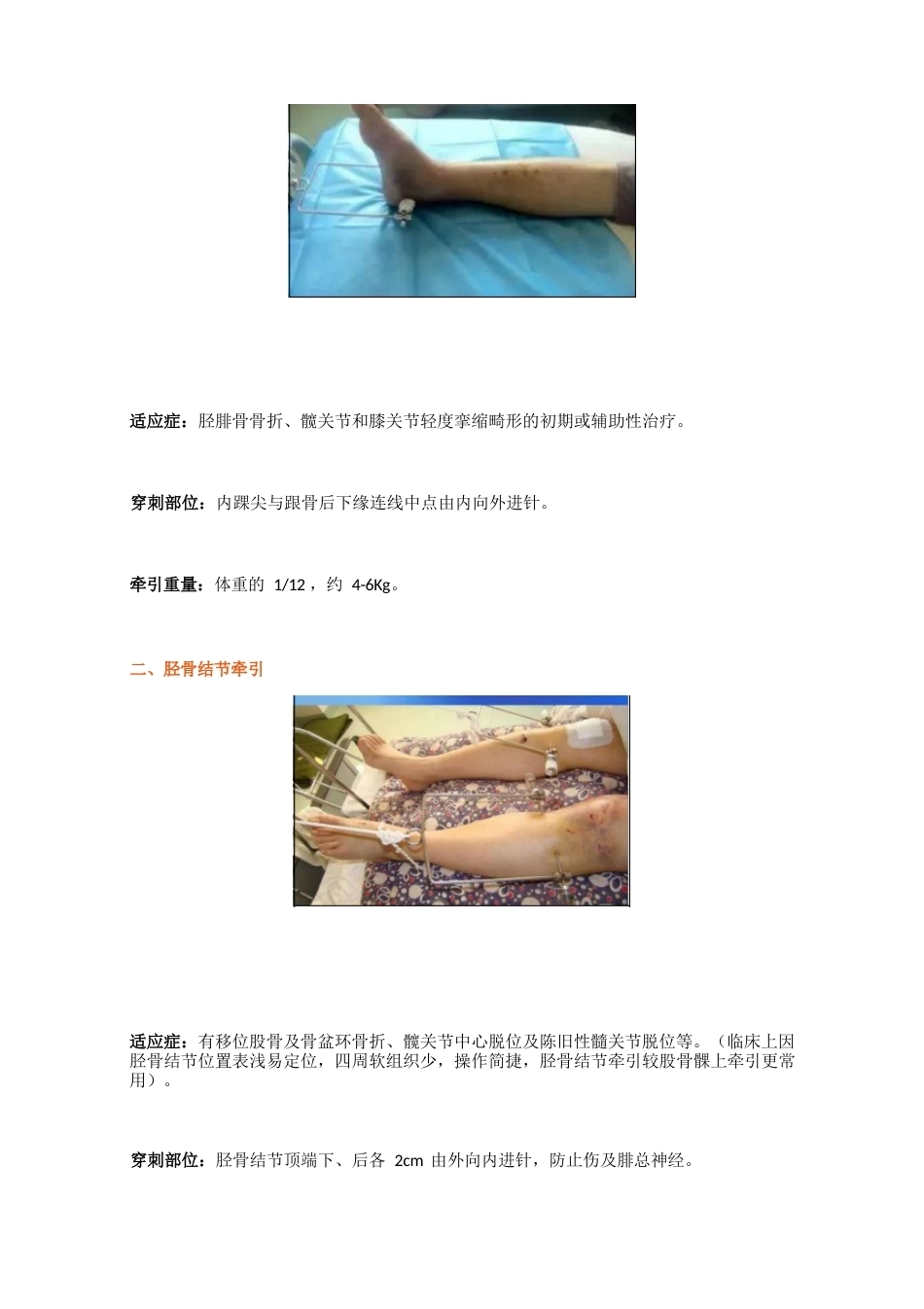 骨科牵引 术(1)_第4页