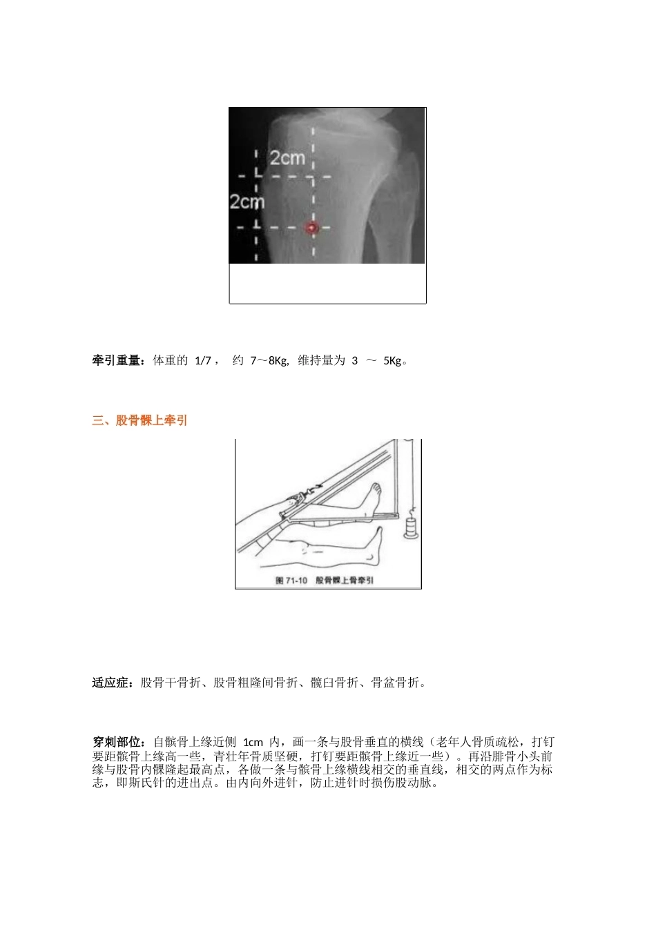 骨科牵引 术(1)_第5页