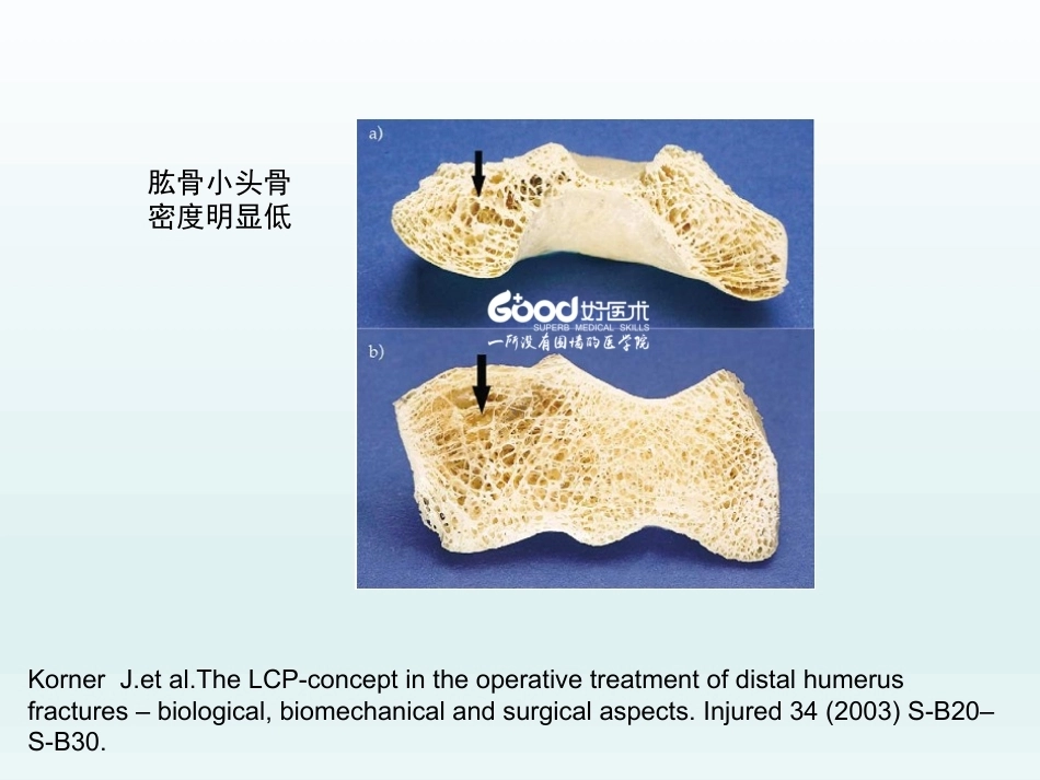 肘关节应用解剖及生物力学(1)_第6页