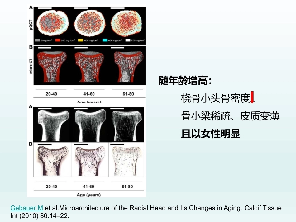 肘关节应用解剖及生物力学(1)_第8页