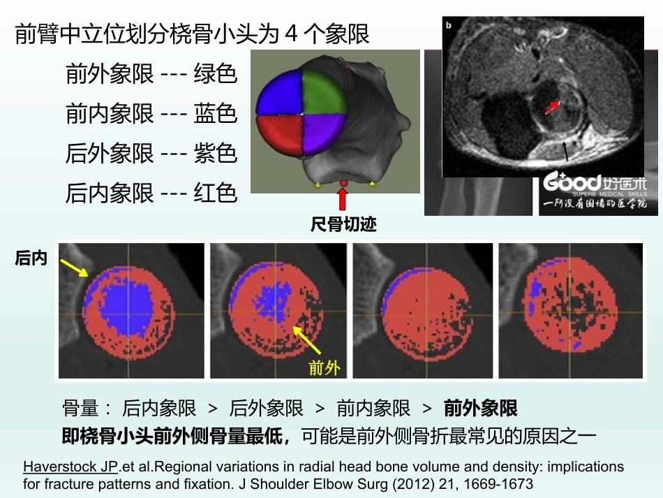 肘关节应用解剖及生物力学(1)_第9页